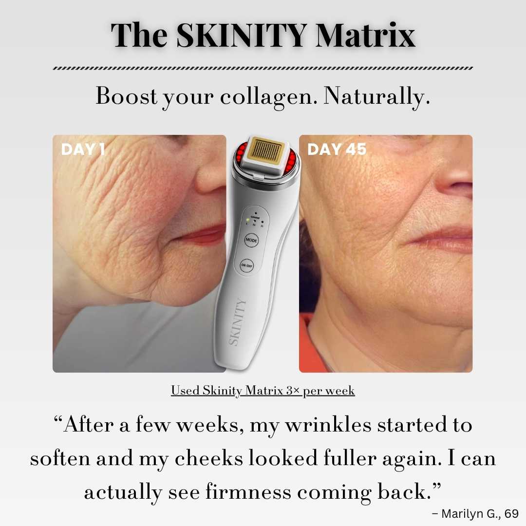 SKINITY MATRIX™