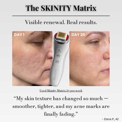 SKINITY MATRIX™